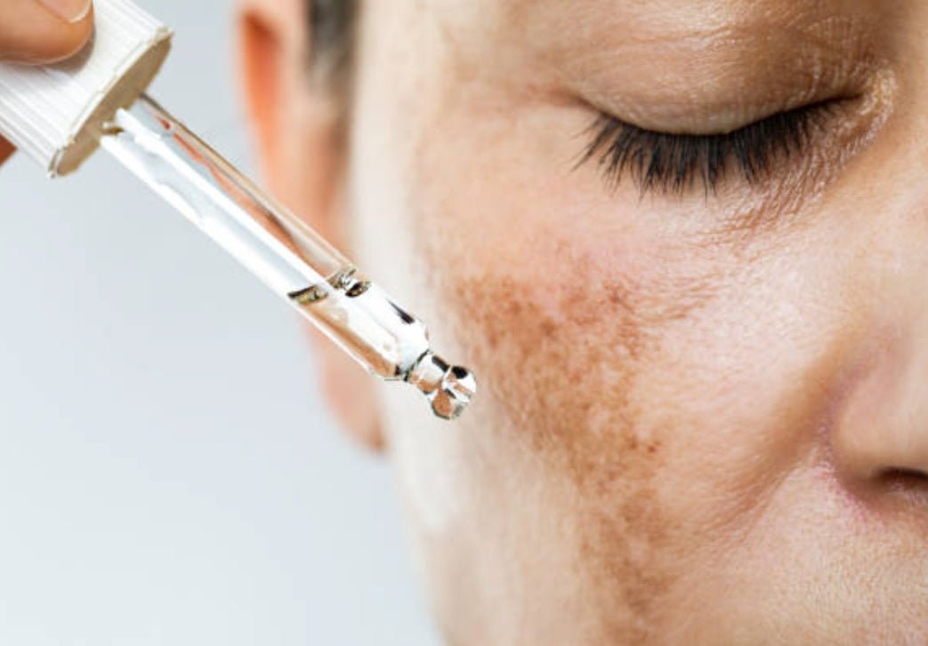 Natural Skincare Products for Hyperpigmentation treatment - Timeless Beauty Cosmetics