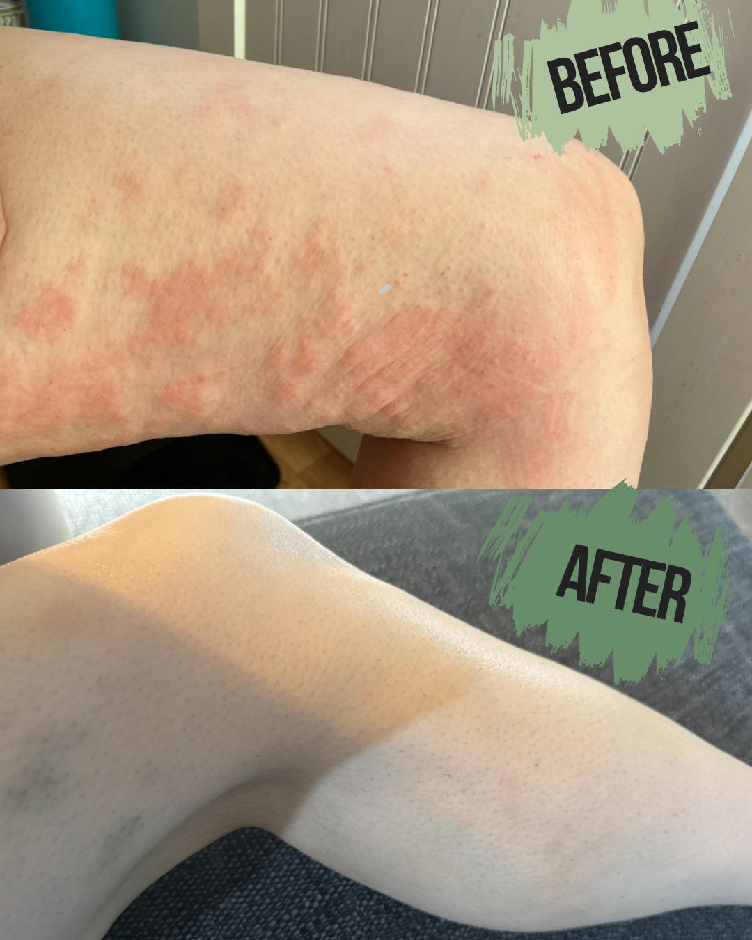 Blackseed & Blue Tansy Skin Rescue renewal Balm - Naturally Sophie Before and after comparison of skin treated with skin rescue balm and the  Charcoal & Oat Cream in 8 days