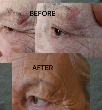 Before and after images showing transformation in skin smoothness and reduction of blemishes with Black Seed Oil blend application.